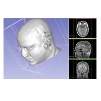 PLASTICART – A Consultation and Training Simulator for Plastic Surgery enriched with AR and VR